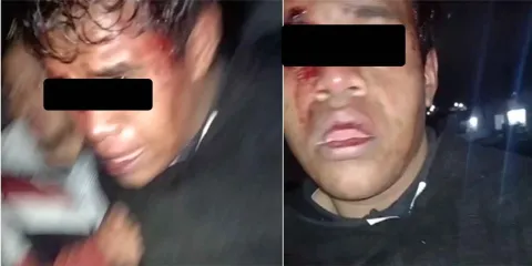 Policía de Huejotzingo rescata a presunto ladrón golpeado por vecinos