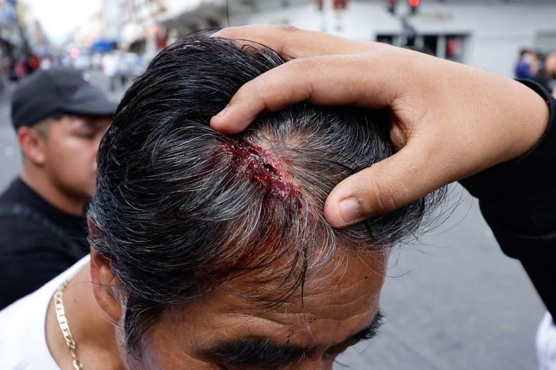 13 lesionados en operativo contra comerciantes en Puebla: uno requirió cirugía