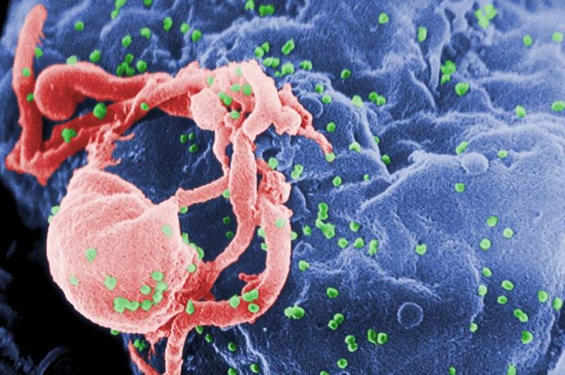 Del miedo al tratamiento: así cambió la lucha global contra el Sida