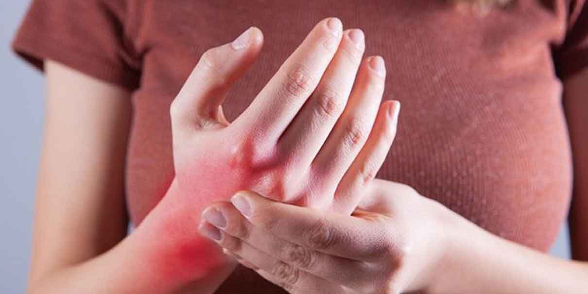Poblanos con LUPUS deben ser incluidos al sistema de salud publico