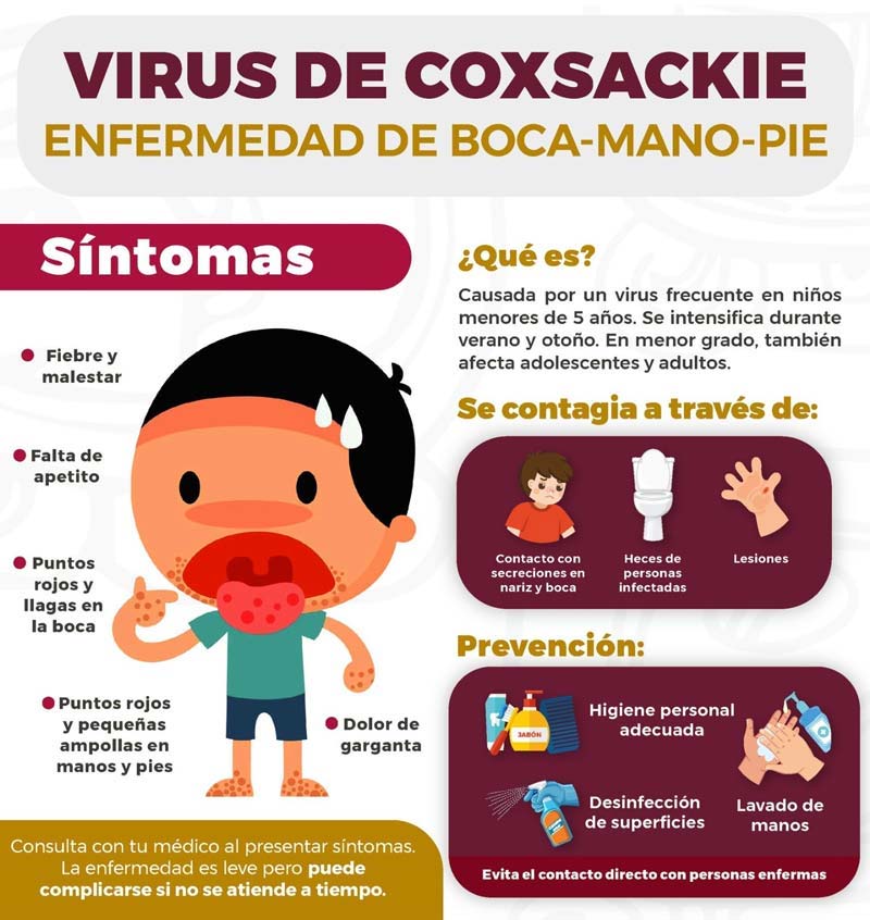 SEP Puebla confirma contagios de virus Coxsackie en escuelas de Chalchicomula y Tlachichuca