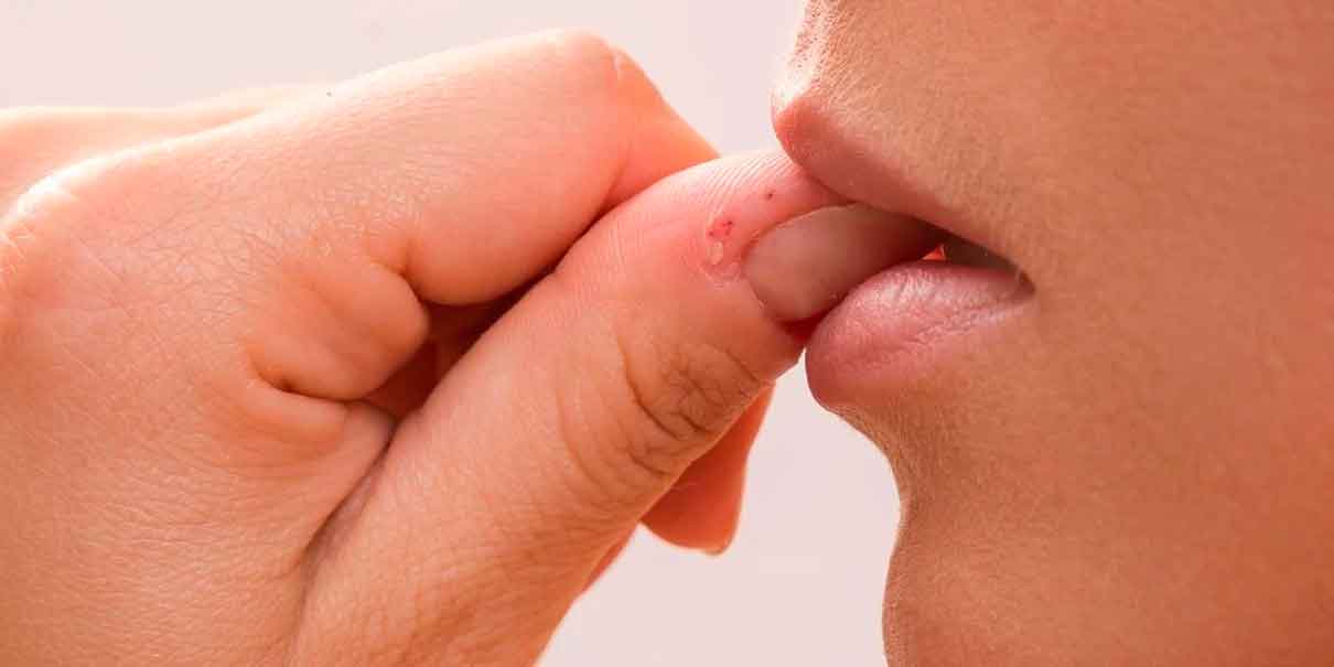 Morderse las uñas