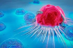 El estrés prolongado y su relación con el CÁNCER: ¿es un factor de riesgo?