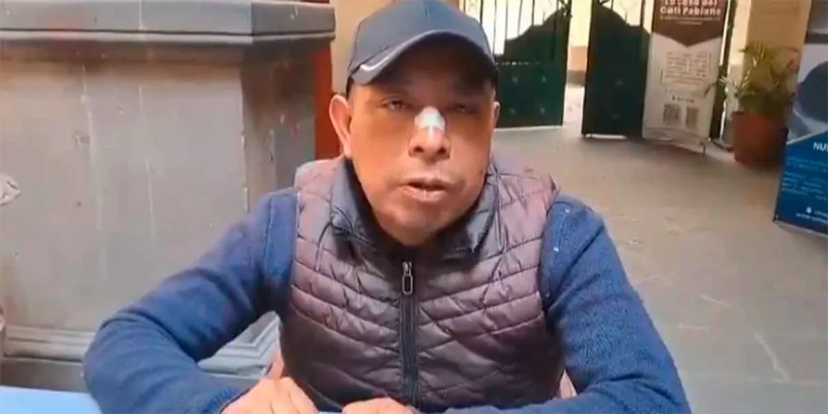 Presidente auxiliar de La Resurrección denuncia agresión por parte de integrantes de Círculo Vino