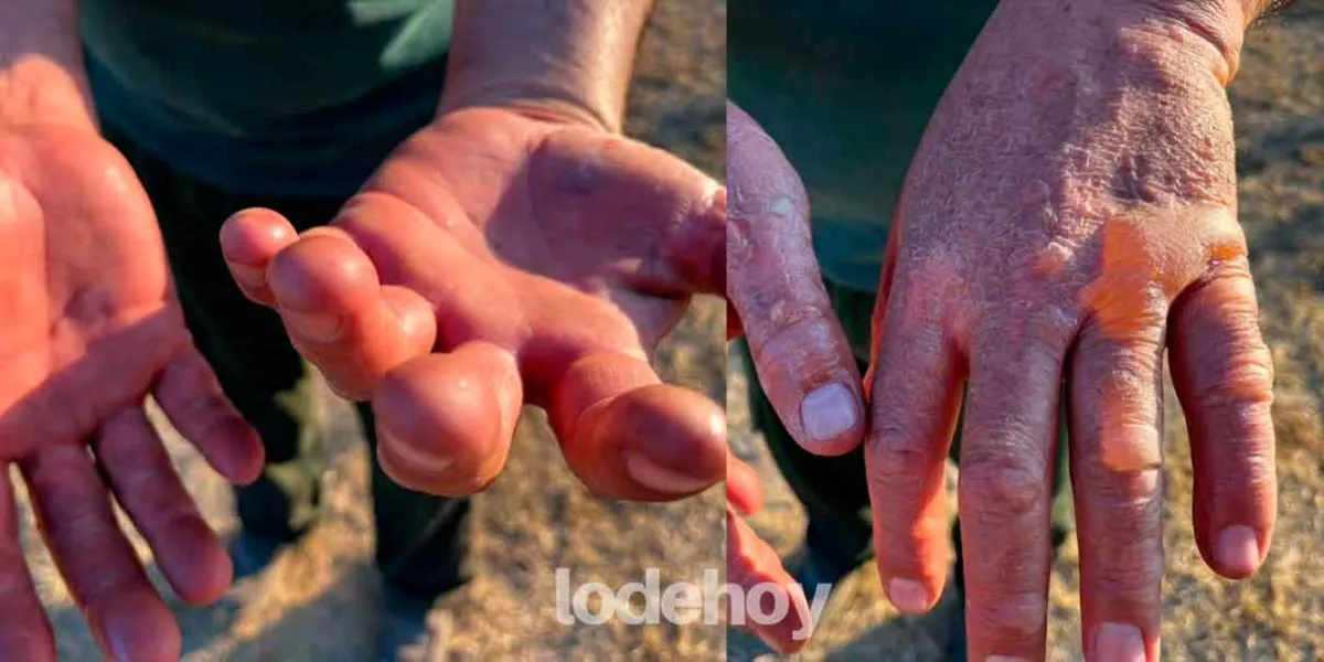 Habitantes de Tlachichuca combaten voraz incendio sin herramientas y sin apoyo de autoridades