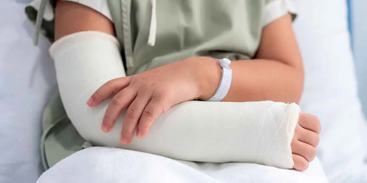 Durante vacaciones aumentan fracturas y quemaduras en niños