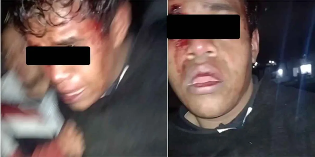 Policía de Huejotzingo rescata a presunto ladrón golpeado por vecinos