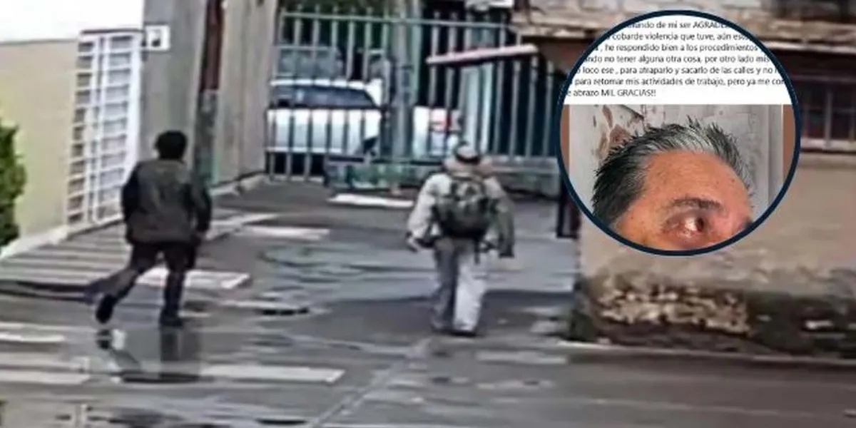 Fotógrafo poblano del Valle de Catrinas es atacado brutalmente en CDMX; agresor sigue prófugo