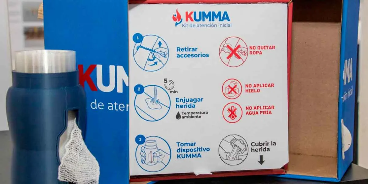 Talentos IBERO Puebla desarrollan un sistema integral para la atención de quemaduras de segundo grado