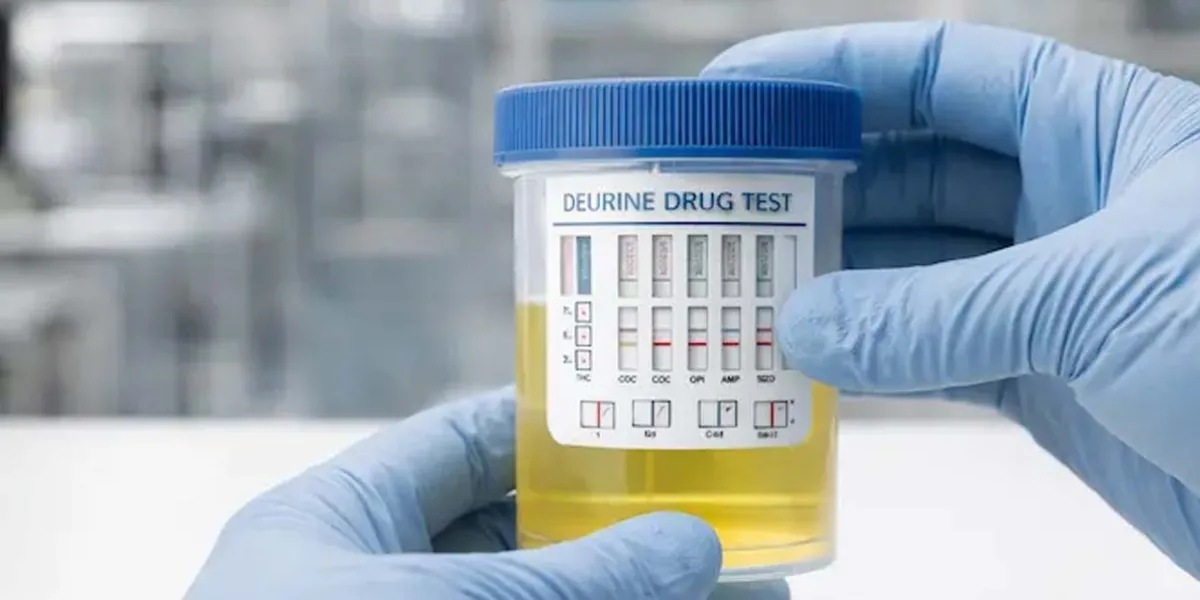 PVEM alista antidoping para candidatos rumbo a elecciones de 2027