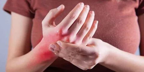Pacientes con Lupus recibirán por ley atención médica