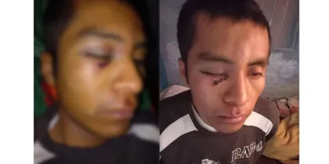 Juan Sosa, viene viene de Tehuacán, es brutalmente golpeado por seis hombres 