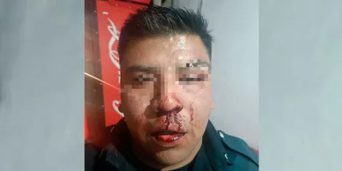 Tras choque le dan golpiza a policía de Texmelucan 