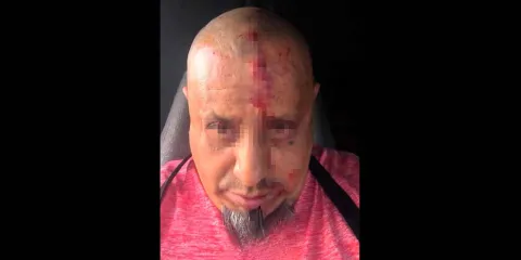 Balean a chofer tras frustrar intento de asalto en la autopista Puebla-Orizaba