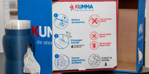 Talentos IBERO Puebla desarrollan un sistema integral para la atención de quemaduras de segundo grado