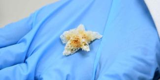 Crea BUAP esponjas biodegradables y nanofibras poliméricas pare regeneración ósea