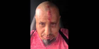 Balean a chofer tras frustrar intento de asalto en la autopista Puebla-Orizaba