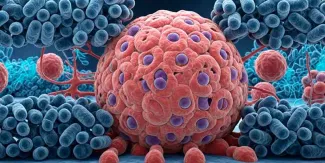 OMS alerta por aumento de casos de cáncer: diagnósticos podrían llegar a 35 millones en 2050