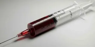 Bluetoothing: qué es la práctica de compartir sangre que alerta por el VIH